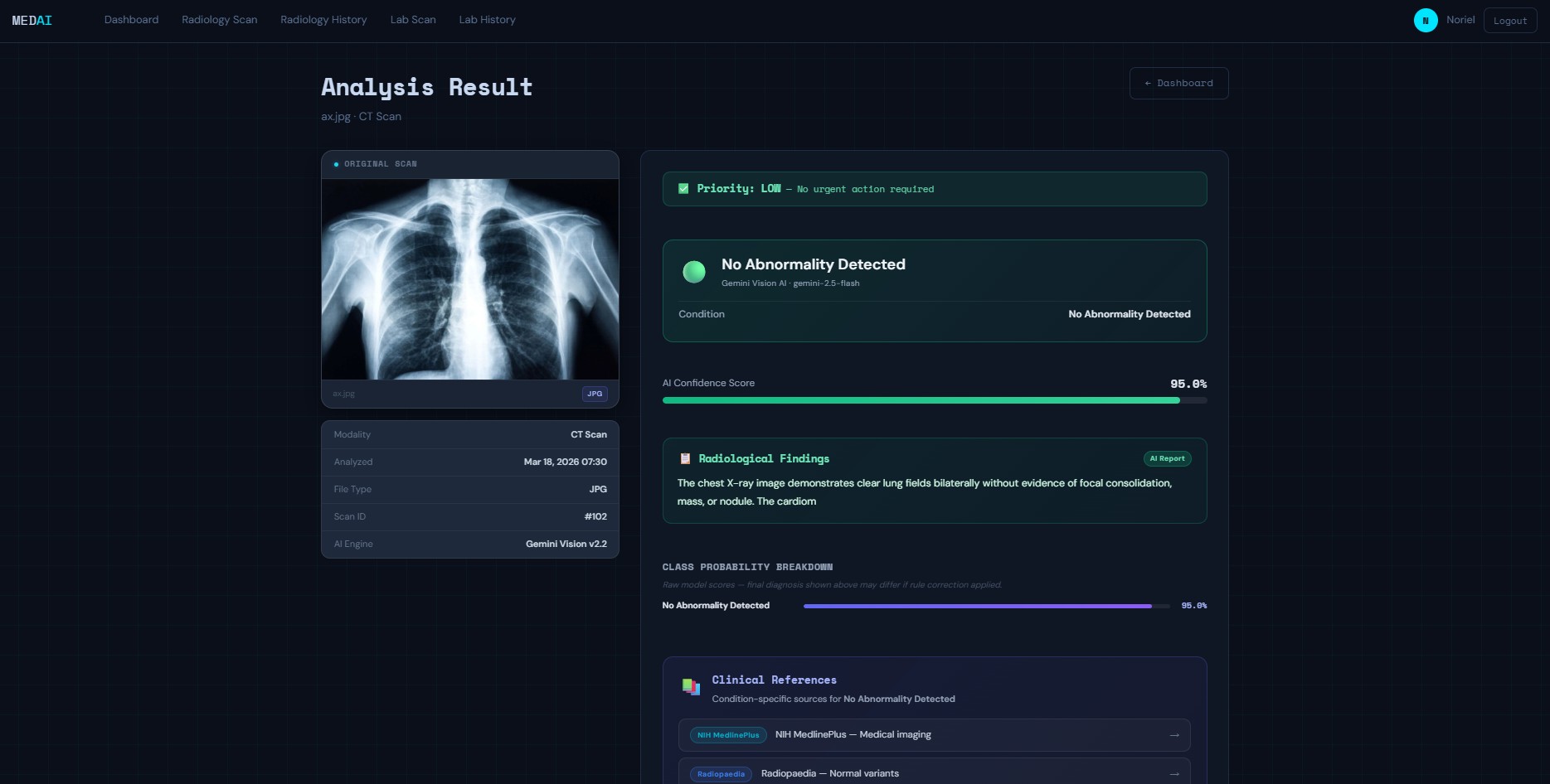 medAI – AI-Powered Radiology & Laboratory Analysis System (MRI, X-Ray, CT, Lab Reports)